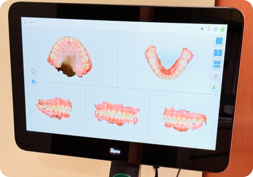 Iteroスキャナー